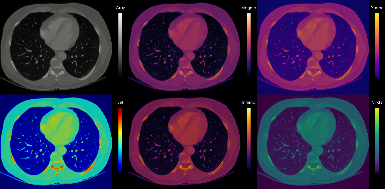 Medical Visualization Colormaps