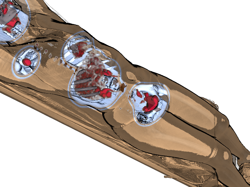 Illustrative rendering of a PET/CT scan